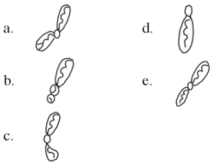 kromosom metasentrik